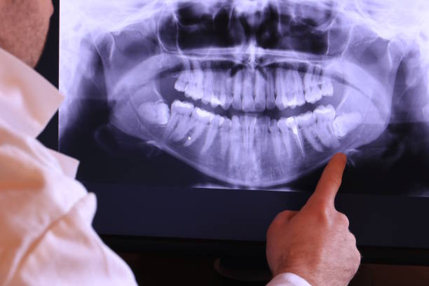 Best Emergency Dental Care for Broken or Chipped Teeth in Weslaco, TX